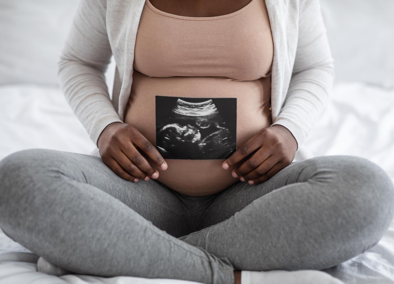 pregnant woman belly with sonogram